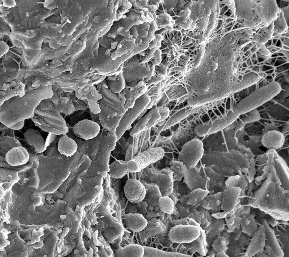 Laboklin: Bakterieller Biofilm mit Mikrobiota. Bildquelle: Lewis Lab, Northeastern University. Aufnahme von: Anthony DʼOnofrio, William H. Fowle, Eric J. Stewart und Kim Lewis.