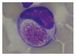 Laboklin: Foa-Kurloff-Zelle mit bis zu 8 μm großem Einschlusskörperchen