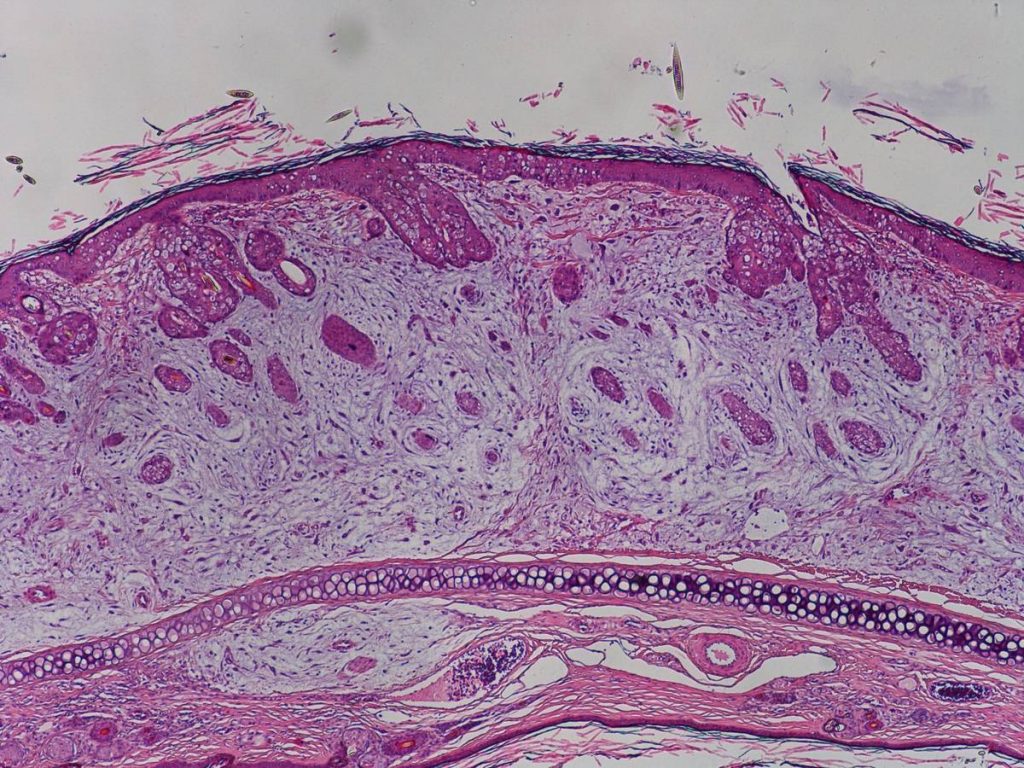 Laboklin: Myxomatose Kaninchen. Haut (Ohr): Proliferation von Spindelzellen („Myxomazellen“) in der Dermis, dazwischen Nachweis einer amorphen, muzinösen Grundsubstanz.