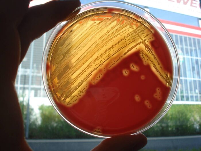 Laboklin: ß-hämolysierende Streptokokken auf einer Blut-Agarplatte