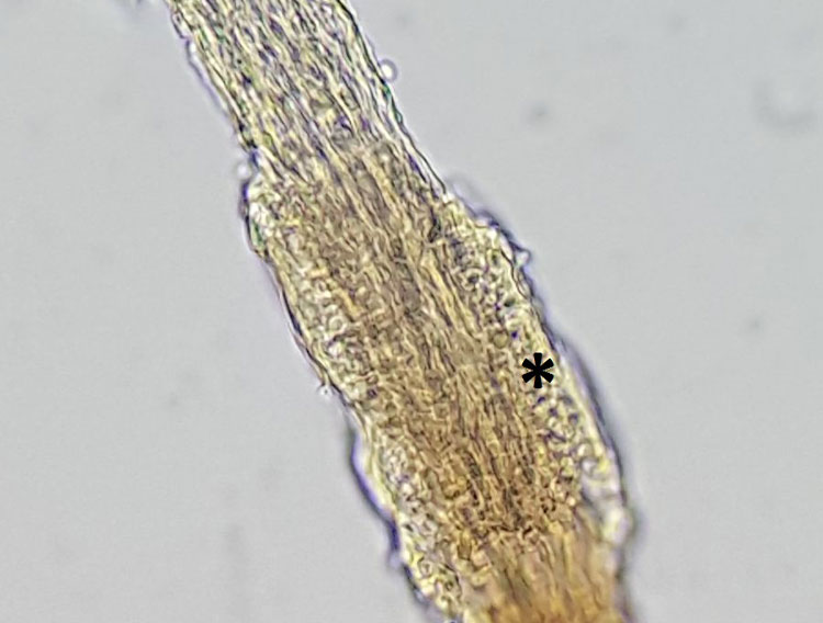 Laboklin: der Haarschaft ist von Pilzhyphen durchzogen, am Rand sind runde Pilzsporen erkennbar (Stern) 