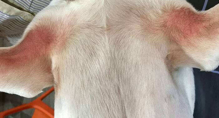 Aufflammen einer atopischen Dermatitis mit Erythem in der Achsel.