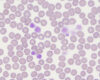 Laboklin: Makrothrombozyten, 1000-fache Vergrößerung, Immersionsöl, Giemsa-Färbung