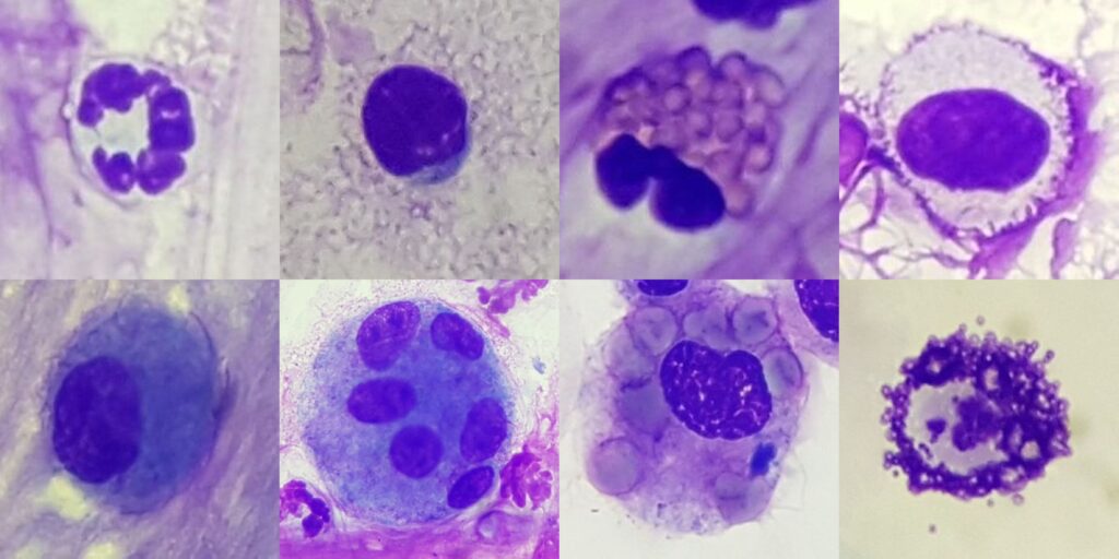 Laboklin: Entzündungszellen; oben v. l. n. r.: Neutrophiler, Lymphozyt, Eosinophiler, Mastzelle (Romanowsky-Schnellfärbung); unten v. l. n. r.: inaktivierter Makrophage, mehrkerniger Makrophage, Erythrophagozytose, Mastzelle (Toluidinblau)