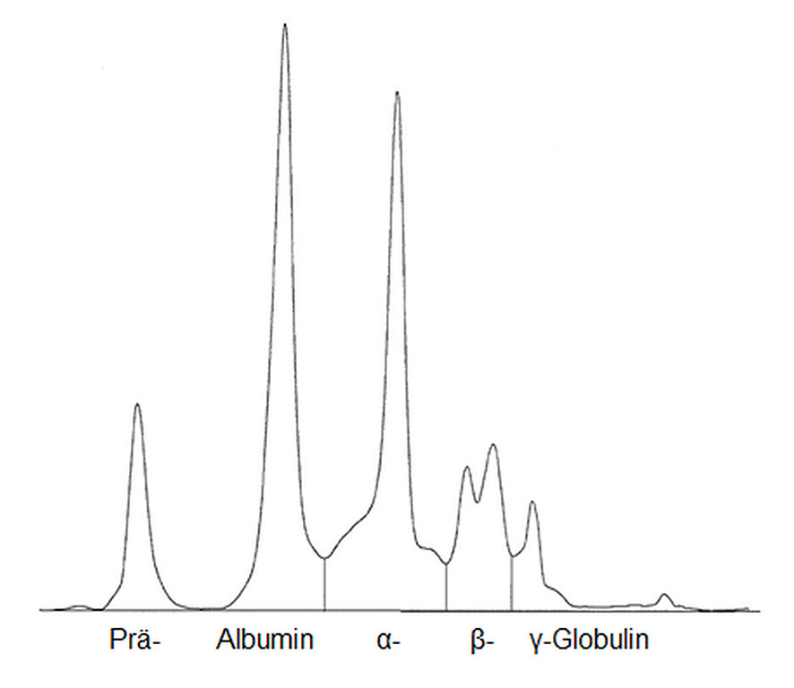 Laboklin: Graphik einer Kapillarelektrophorese aus Plasma einer gesunden Griechischen Landschildkröte (Testudo hermanni)