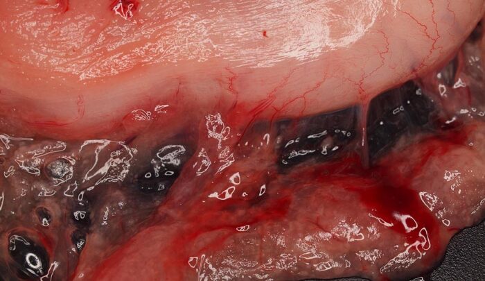 Laboklin: Akute, eitrige Pankreatitis bei einer 12-jährigen Katze, die perakut verstorben ist 