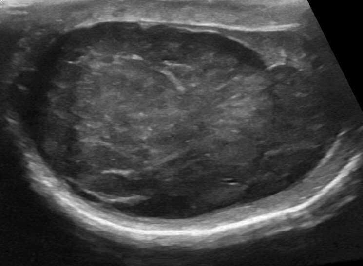 Laboklin: Ultraschallbild eines Hodentumors Bildquelle: Dr. Beate Walter, LMU München