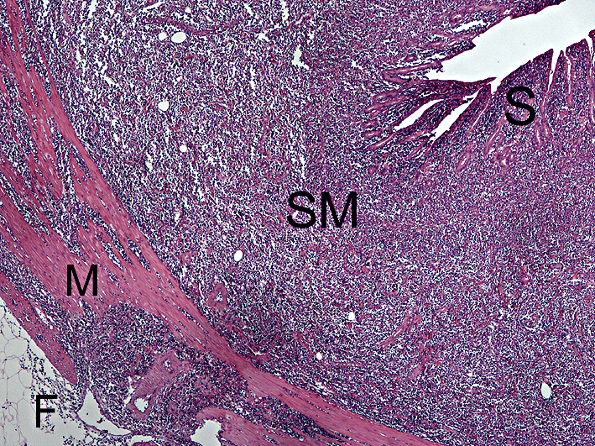 Laboklin: Intestinales Lymphom mit transmuraler Infiltration der Tumorzellen (S = Schleimhaut, SM = Submukosa, M = Muskularis, F = Fettgewebe)