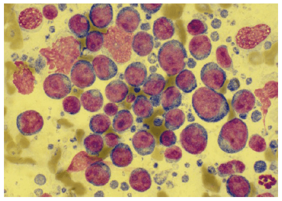 Laboklin: Lymphknoten; die Zellen liegen im Monolayer, die Färbequalität ist gut, ein Lymphom kann diagnostiziert werden