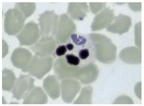 Laboklin: Anaplasma phagozytophilum (Morula)