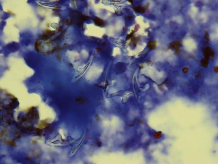 Laboklin: Leberpunktat mit Echinokokken-Häkchen 