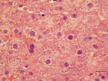 Laboklin: Histologisches Bild der Leber eines Pferdes mit Jakobkreuzkraut-Vergiftung. Die Leberzellen zeigen sich teilweise vergrößert mit wenigen doppel- und vielkernigen Zellen (H&E, 1000-fache Vergrößerung).