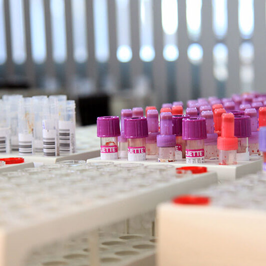 auspacker probeneingang