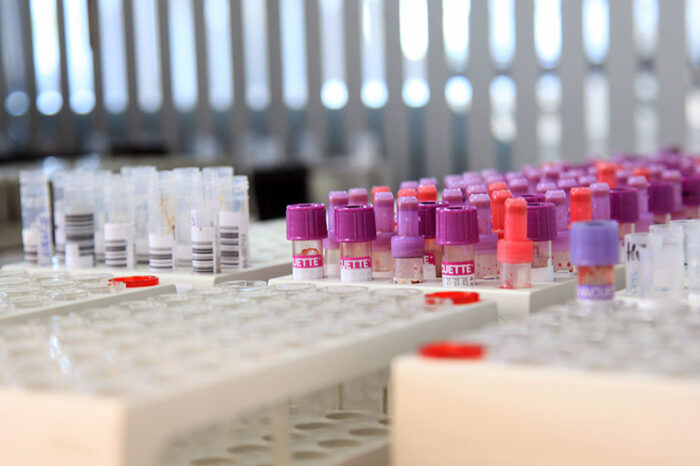 auspacker probeneingang