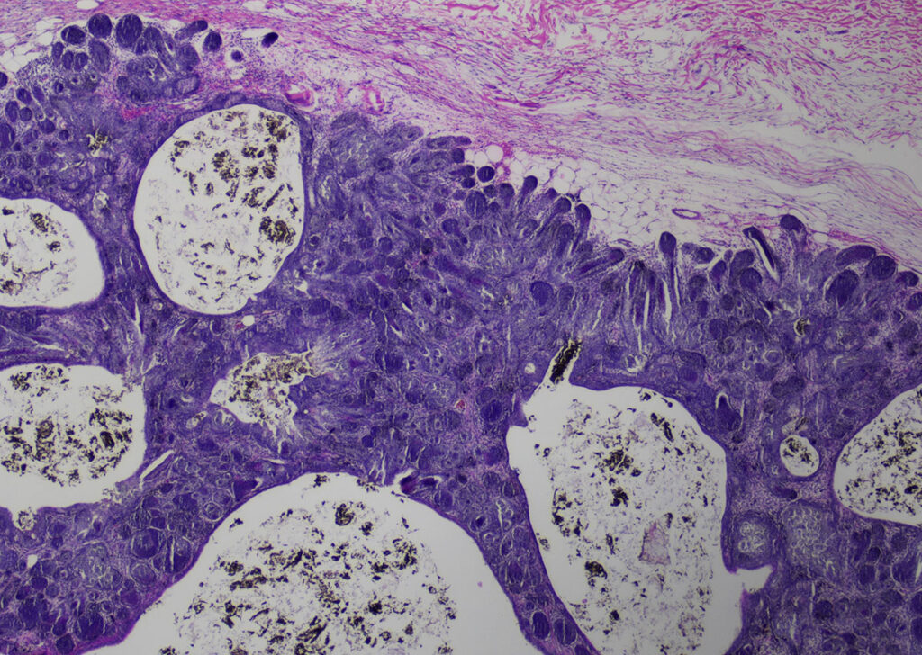Tumor,Meerschweinchen,Spontantumoren,retrospektive Auswertung von Tumoren,Tumorlokalisationen