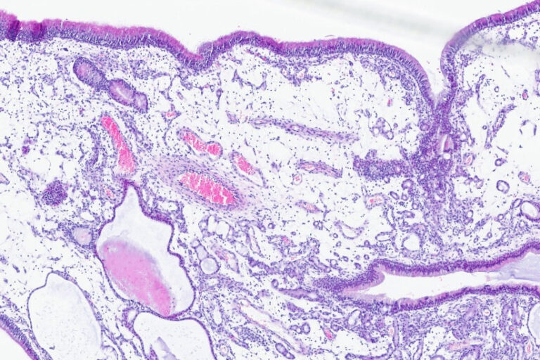 Histologie eines nasalen Polypen eines Hundes, 4er Vergrößerung, HE-Färbung
