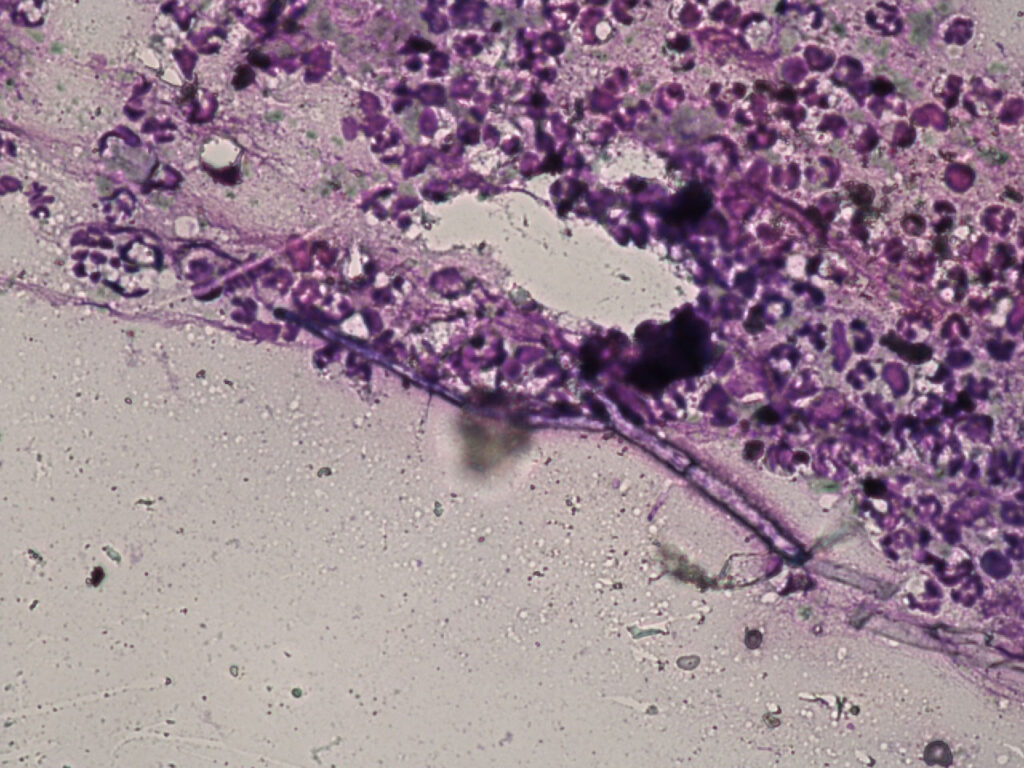 Zytologie eines Ausstriches aus der Nasenhöhle eines Hundes zeigt Pilzhyphen, 40er Vergrößerung