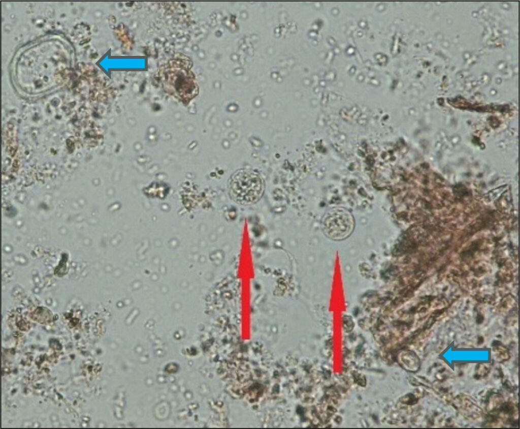 polle und pflanzenrueckstaende