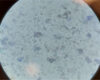 Kaninchenharn unter dem Mikroskop (nativ mit Methylenblau,
nicht zentrifugiert, 400-fache Vergrößerung) mit zahlreichen
polymorphen Calciumkarbonaten und -phosphaten und
einzelnen Epithelzellen