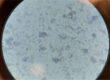 Kaninchenharn unter dem Mikroskop (nativ mit Methylenblau,
nicht zentrifugiert, 400-fache Vergrößerung) mit zahlreichen
polymorphen Calciumkarbonaten und -phosphaten und
einzelnen Epithelzellen