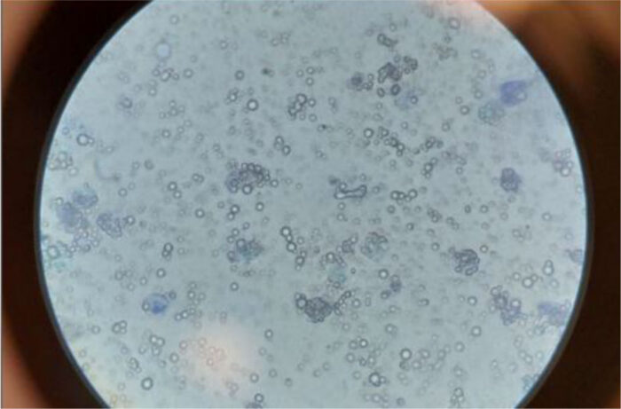 Kaninchenharn unter dem Mikroskop (nativ mit Methylenblau,
nicht zentrifugiert, 400-fache Vergrößerung) mit zahlreichen
polymorphen Calciumkarbonaten und -phosphaten und
einzelnen Epithelzellen