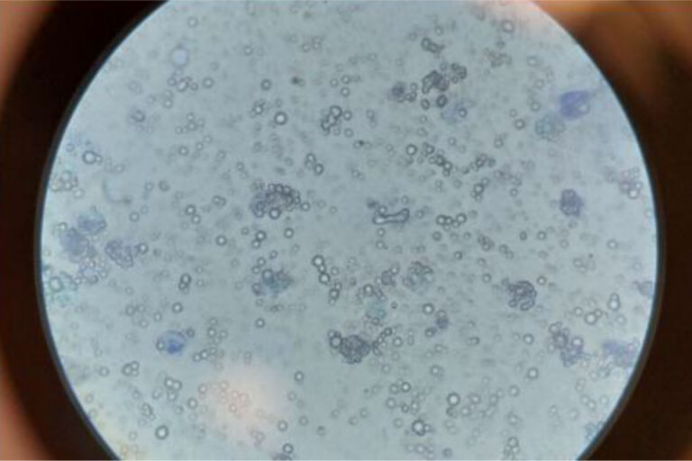Kaninchenharn unter dem Mikroskop (nativ mit Methylenblau,
nicht zentrifugiert, 400-fache Vergrößerung) mit zahlreichen
polymorphen Calciumkarbonaten und -phosphaten und
einzelnen Epithelzellen