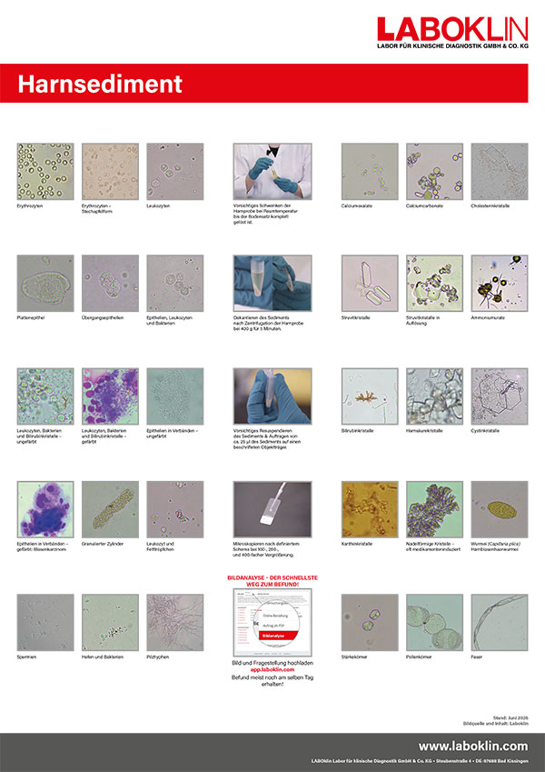 poster harnsediment 01 26